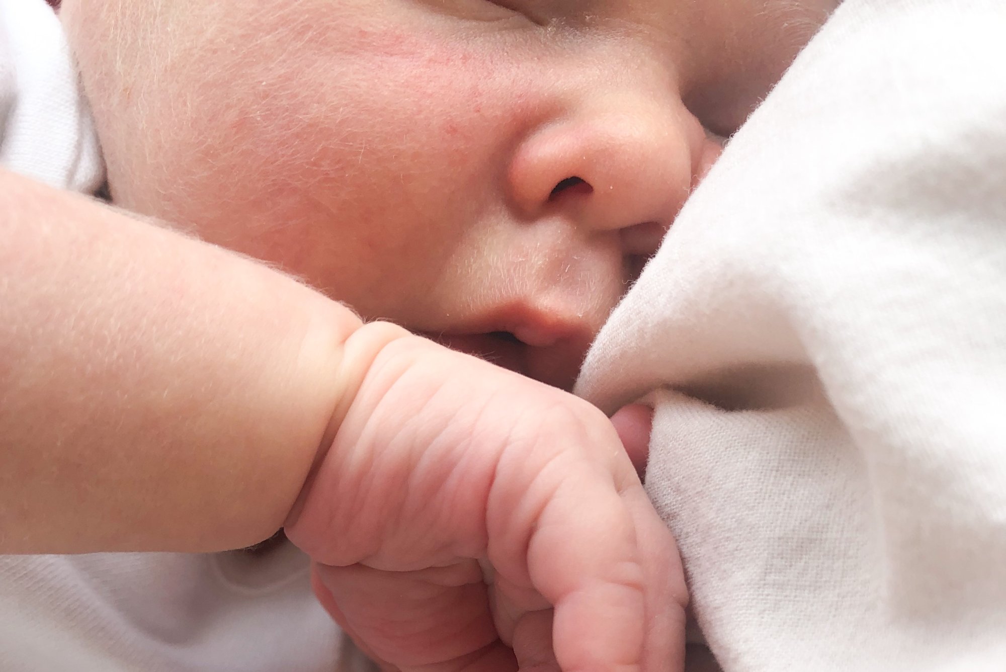 Novorozenecké akné