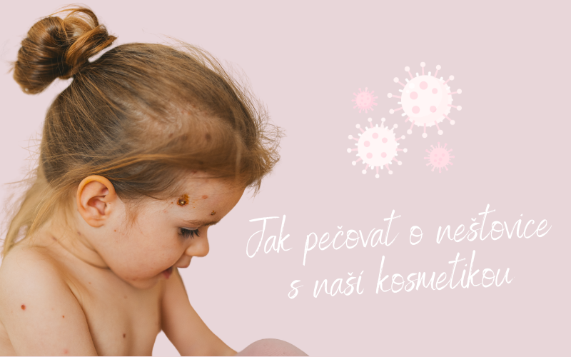 Jak pečovat o neštovice s kosmetikou Protože JSI