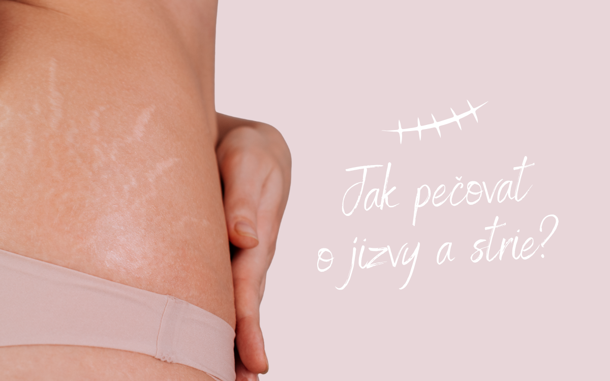Jak pečovat o jizvy a strie