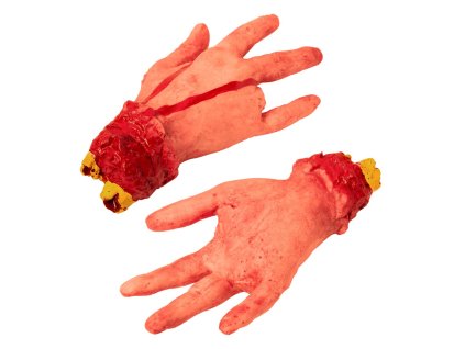 Usekla ruka bez prstu