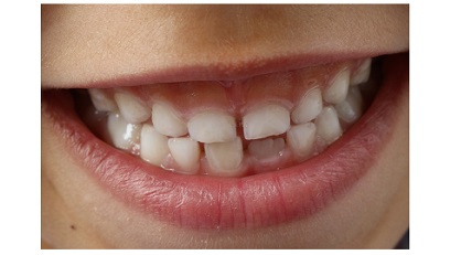 Kdy začít s čištěním zoubků?