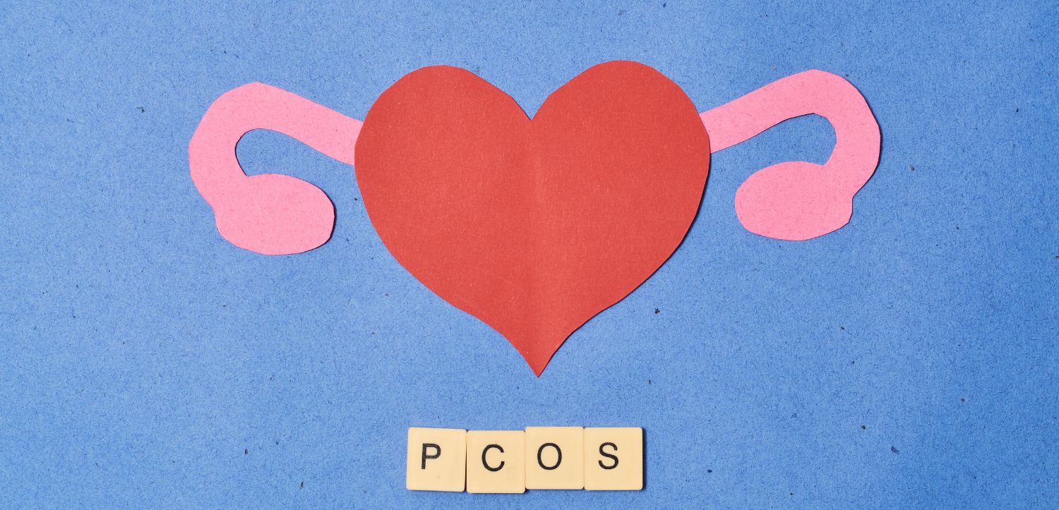 PCOS: Když hormony hrají podle vlastních pravidel