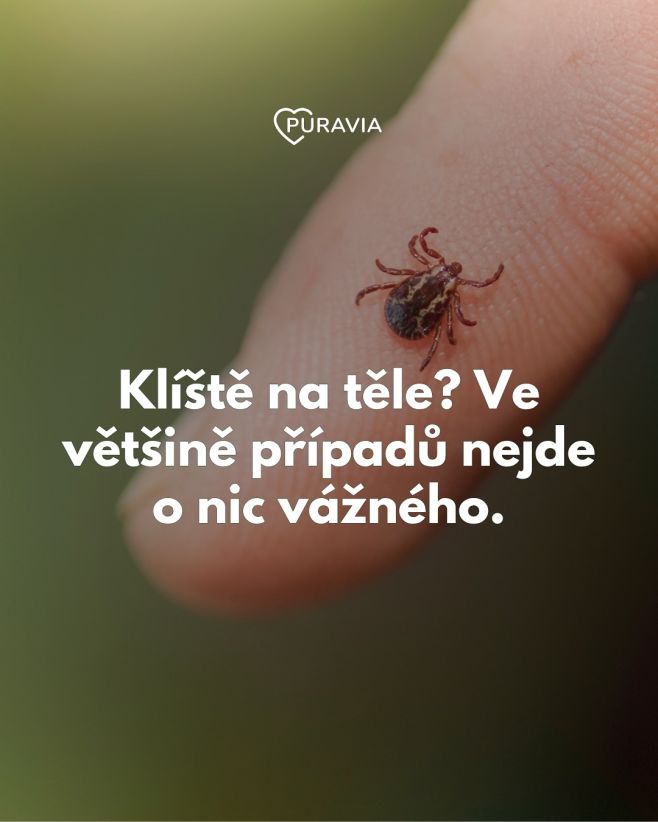 🕷️ Klíšťata v létě nejsou důvod k panice! Většina z nich nemoc nepřenáší a když je včas odstraníte, riziko je opravdu...