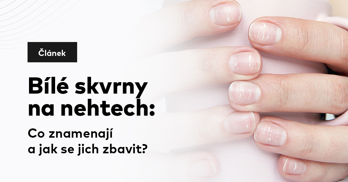 Bílé skvrny na nehtech: Co znamenají a jak se jich zbavit?