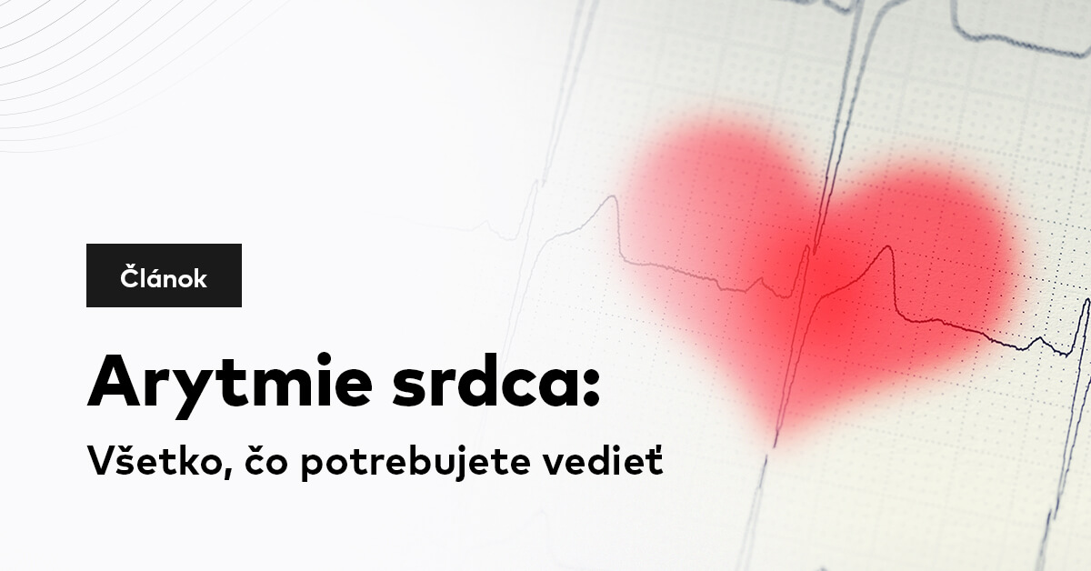 Arytmie srdca: Všetko, čo potrebujete vedieť