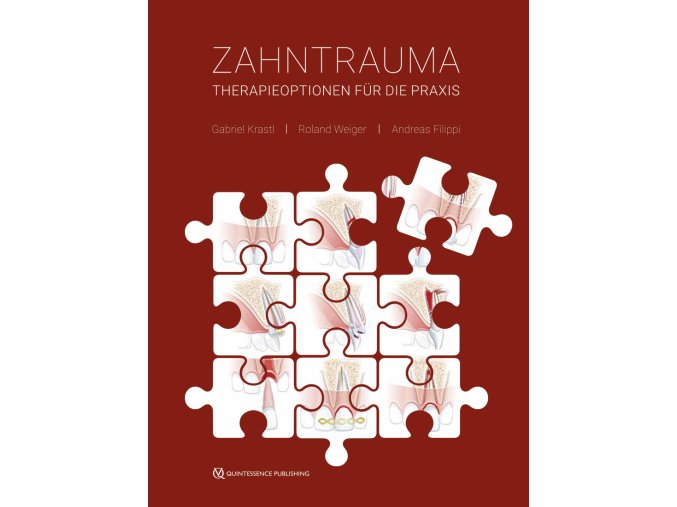 17280 Cover Krastl Weiger Filippi Zahntrauma