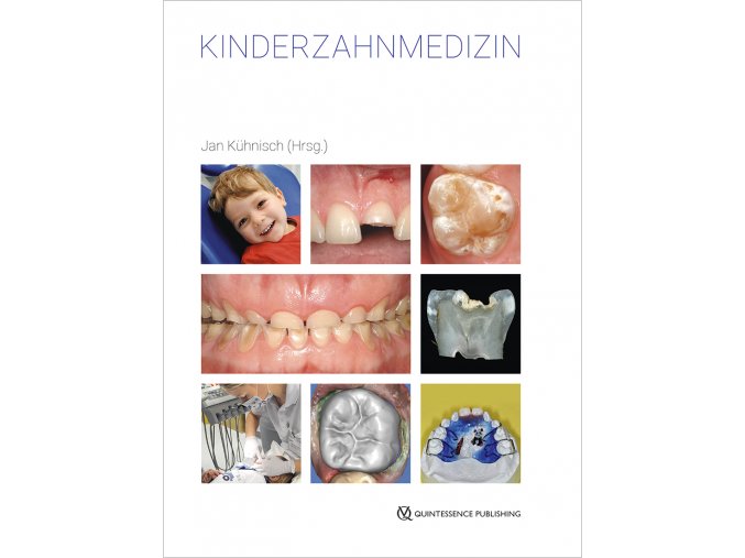 22700 Cover Kuehnisch Kinderzahnmedizin