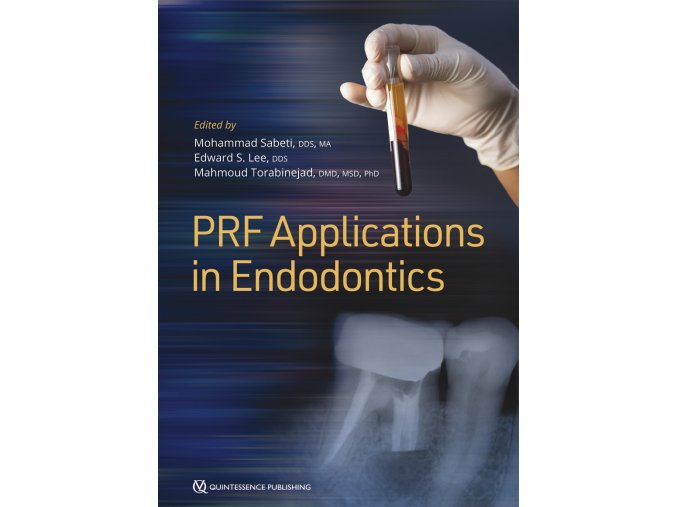 22091 Cover Sabeti PRF Applications in Endodontics