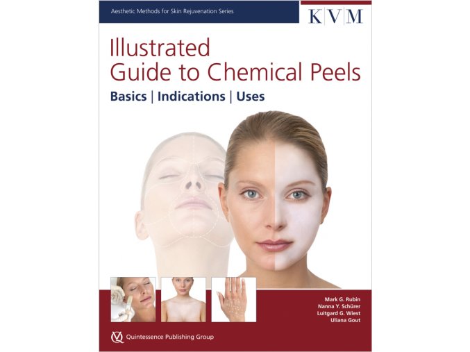 30133 Rubin IG Chemical Peels