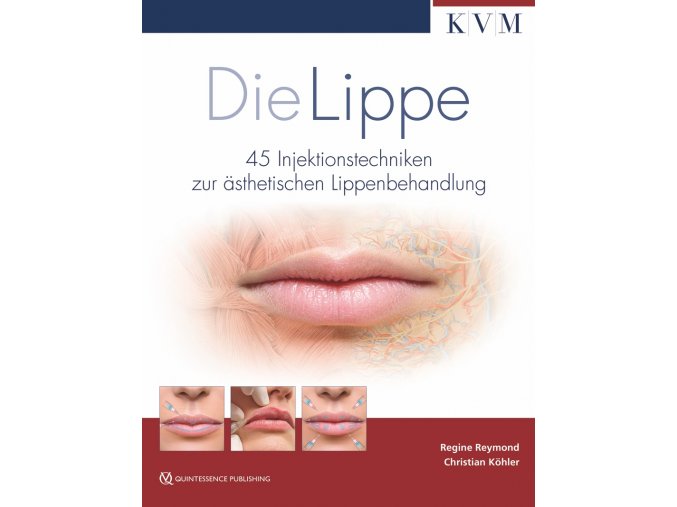 30246 cover reymond die lippe