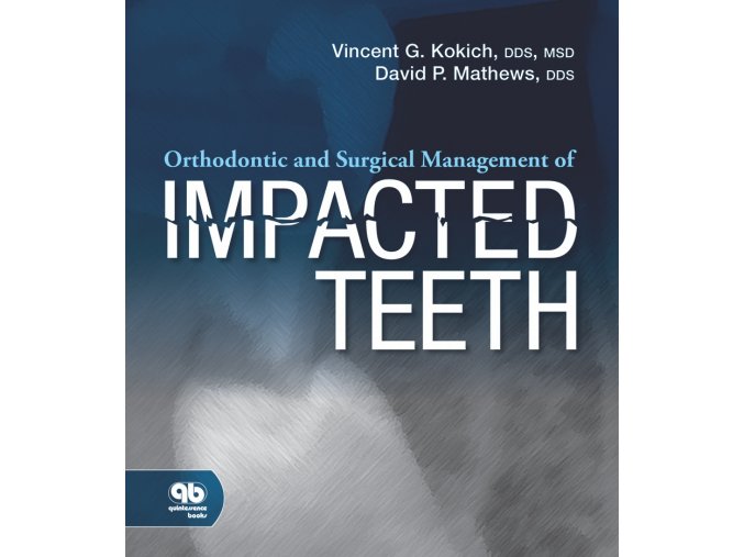 16121 cover kokich impacted teeth