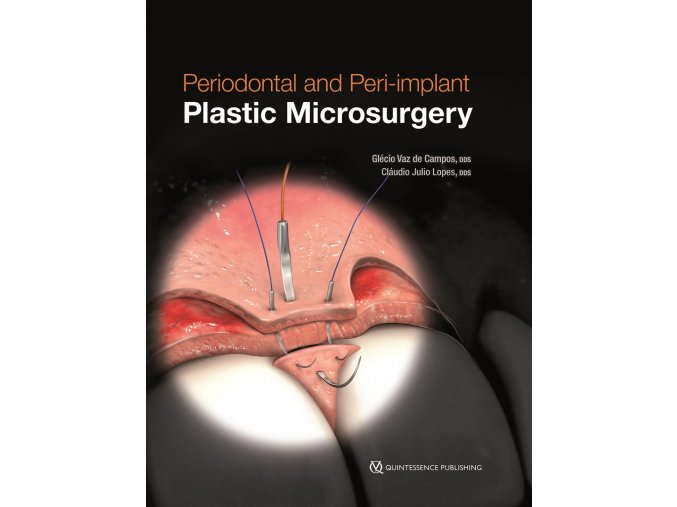 22641 cover campos periodontal and periimplant plastic microsurgery