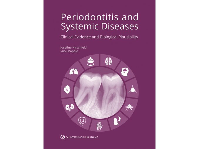 22111 cover hirschfeld periodontitis systemic diseases