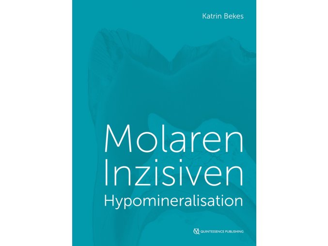 22730 cover bekes molaren inzisiven hypomineralisation