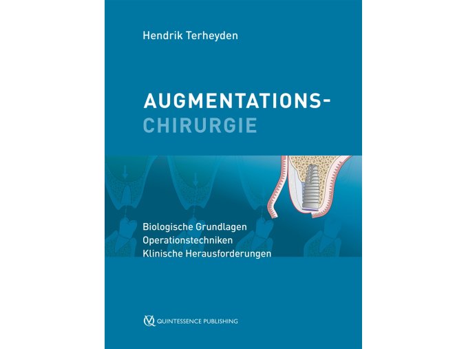 22580 cover terheyden augmentationschirurgie