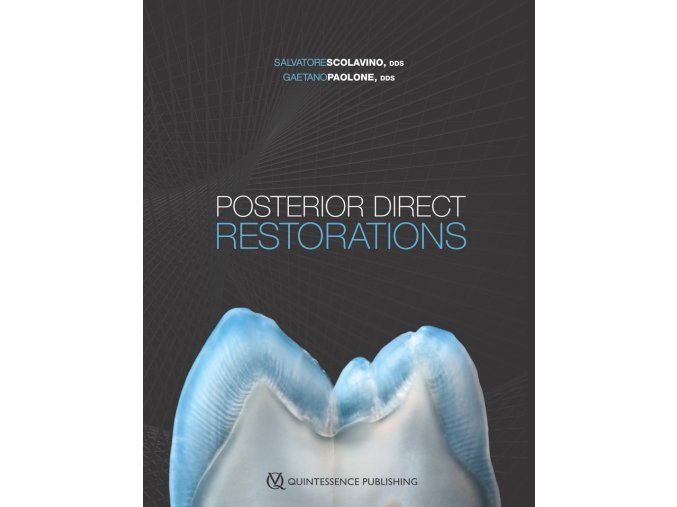 22471 cover scolavino posterior direct restorations(1)