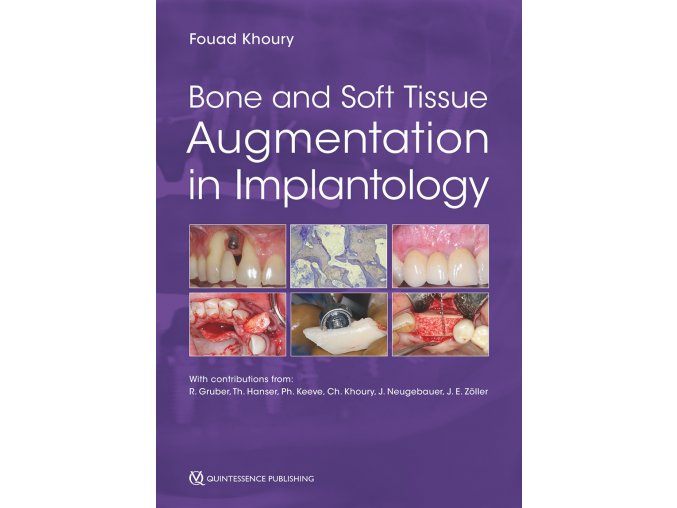 14891 cover khoury bone and soft tissue augmentation in implantology