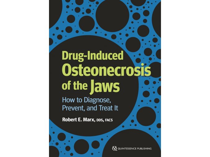 23861 cover marx drug induced osteonecrosis of the jaws