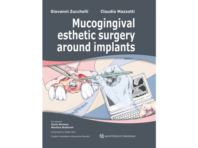 24311 cover slipcase zucchelli mucogingival esthetic surgery around implants