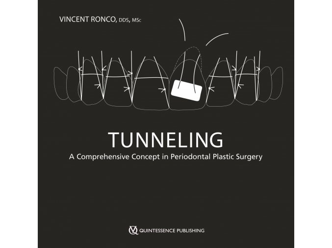 24001 cover ronco tunneling