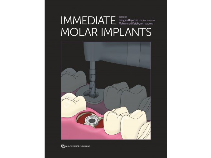 24111 cover deporter immediate molar implants