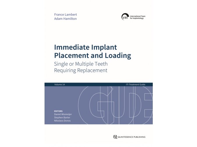 Immediate Implant Placement and Loading – Single or Multiple Teeth Requiring Replacement