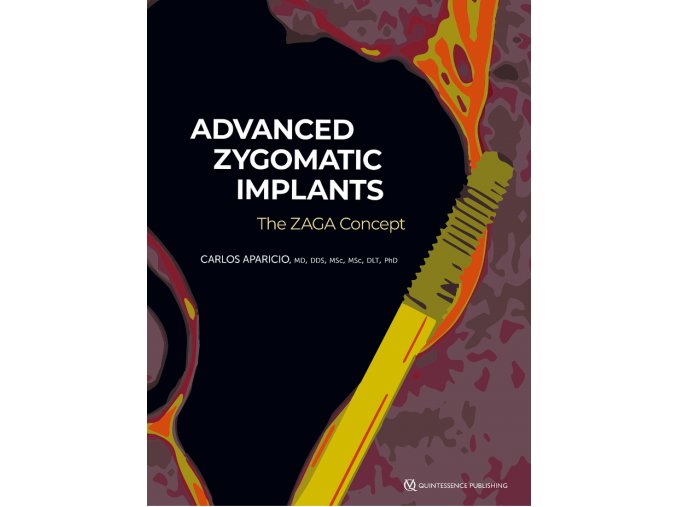 Advanced Zygomatic Implants