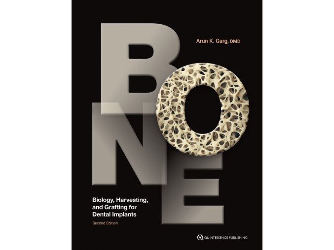 Bone