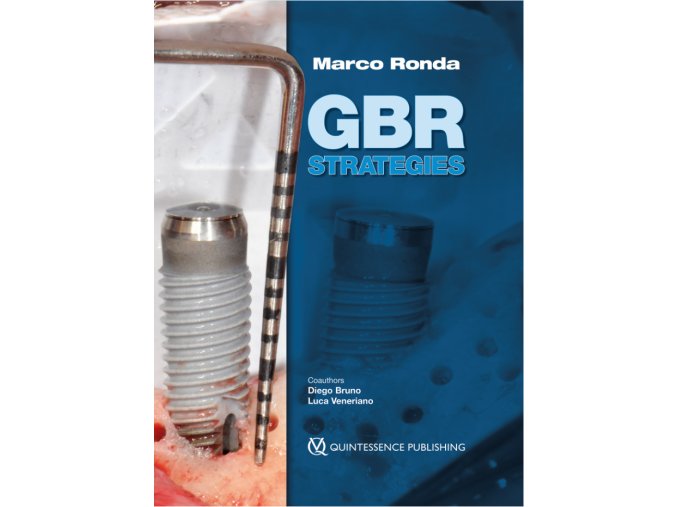 GBR Strategies