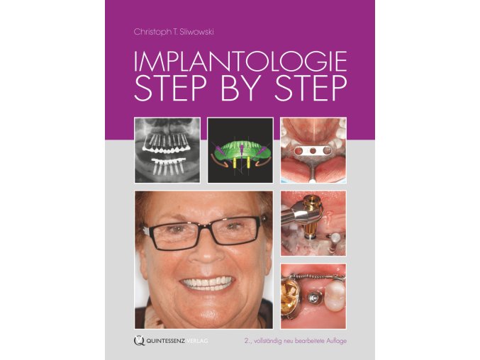 Implantologie Step by Step