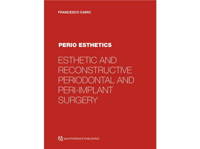 Perio Esthetics
