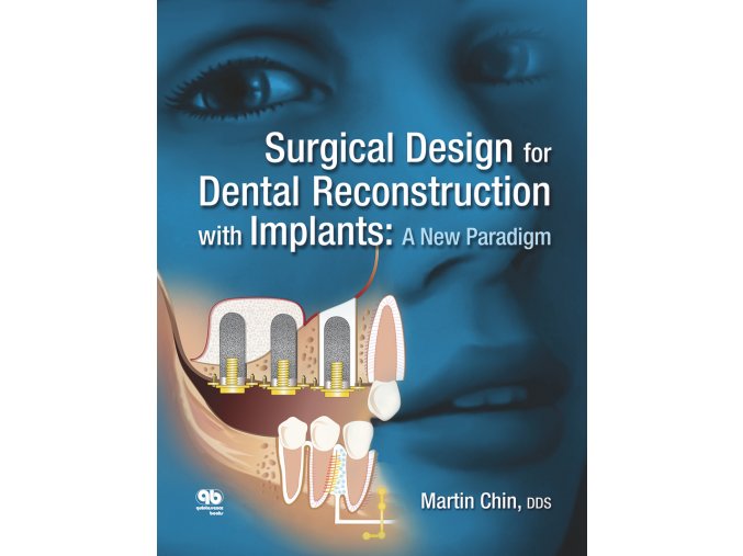 Surgical Design for Dental Reconstruction with Implants