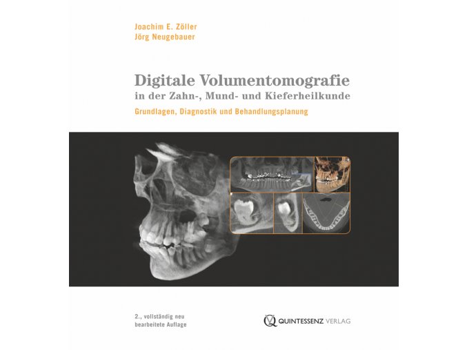 Digitale Volumentomografie in der Zahn , Mund und Kieferheilkunde