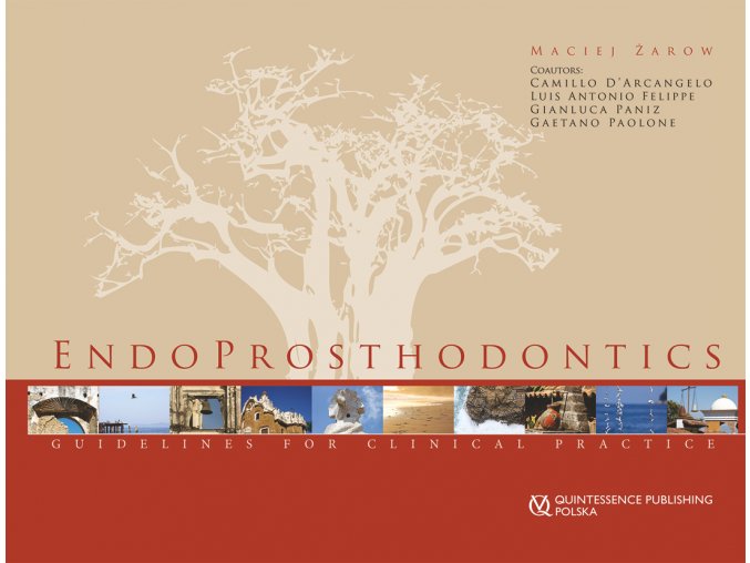 12131 Cover Zarow EndoProsthodontics