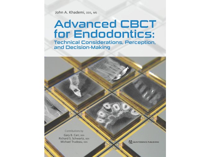 Advanced CBCT for Endodontics: