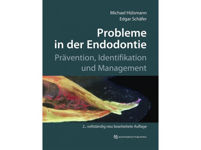 16480 Cover Huelsmann Schaefer Probleme in der Endodontie 2Aufl