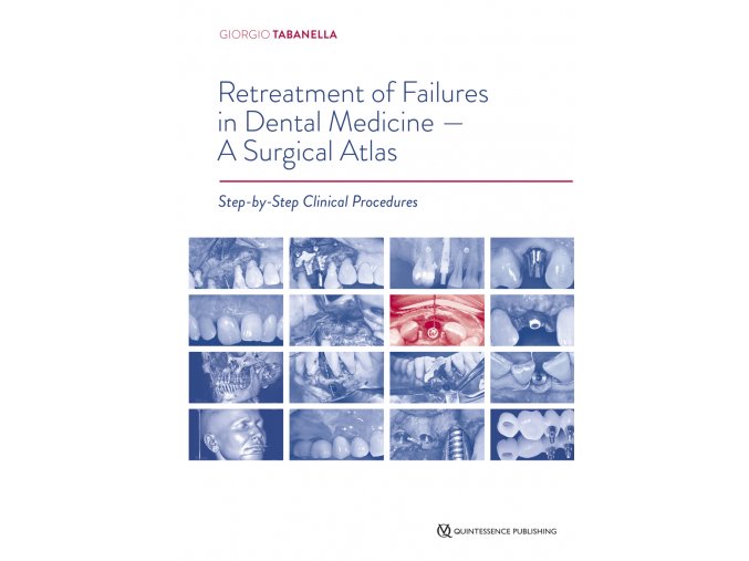 22391 Cover Tabanella Retreatment of Failures in Dental Medicine