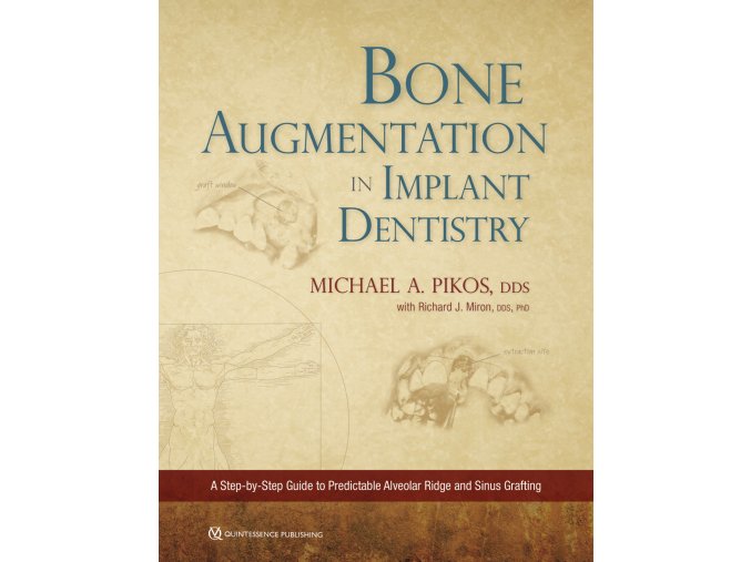 Cover 22081 Pikos Bone Augmentation in Implant Dentistry