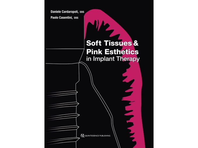 21881 Cover Cardaropoli Soft Tissues and Pink Esthetics in Implant Therapy