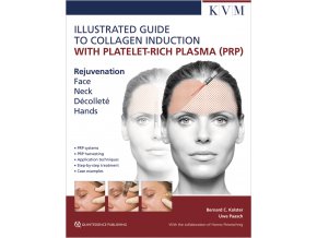 30253 Cover Illustrated Guide to Collagen Induction with PRP