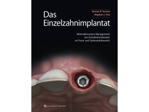 22830 Cover Tarnow Das Einzelzahnimplantat