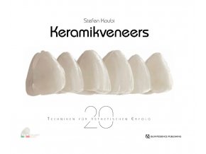 22290 Cover Koubi Keramikveneers