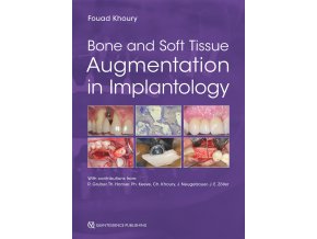 14891 cover khoury bone and soft tissue augmentation in implantology