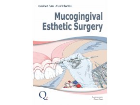 Mucogingival Esthetic Surgery