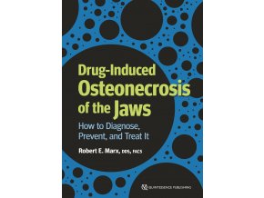 23861 cover marx drug induced osteonecrosis of the jaws