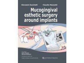 24311 cover slipcase zucchelli mucogingival esthetic surgery around implants