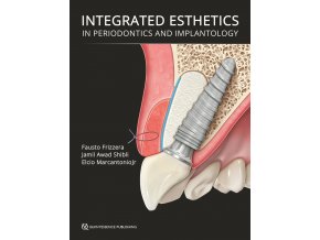 22381 cover frizzera integrated esthetics in periodontics and implantology