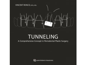 24001 cover ronco tunneling