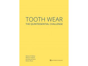 21891 cover vilaboa tooth wear