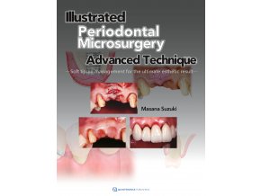 22741 cover suzuki the illustrated advanced technique of periodontal microsurgery